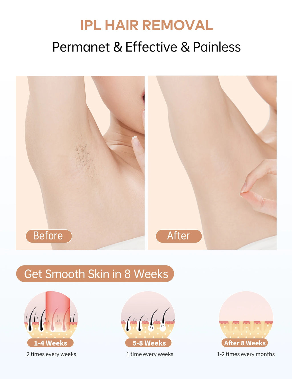 At Home Professional Laser Hair Removal
